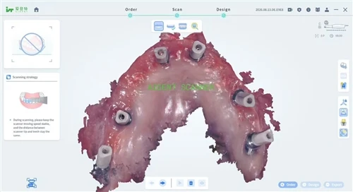 Processing Intraoral Scan Data in 3Shape Dental System